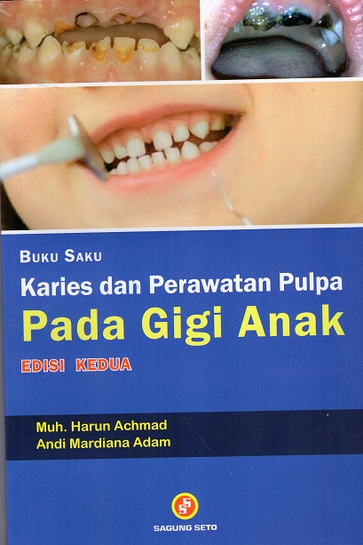 Buku saku karies dan perawatan pulpa pada gigi anak