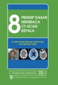 8 prinsip dasar membaca CT-SCAN kepala