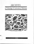 Archives of pathology &  laboratory medicine : invasive micropapillary carcinoma