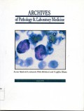 Archives of pathology & laboratory medicine : acute myeloid leukemia with bilobed and cuplike blasts