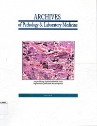 Archives of pathology & laboratory medicine atypical large epitheliold cells from ...