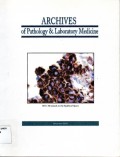 Archives of pathology & laboratory Medicine : HCC Metastasis to the epidural space