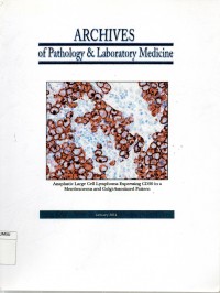 Archives of pathology & laboratory medicine : anaplastic large cell lymphoma expressing...