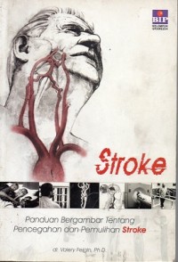 Stroke : panduan bergambar tentang pencegahan dan pemulihan stroke